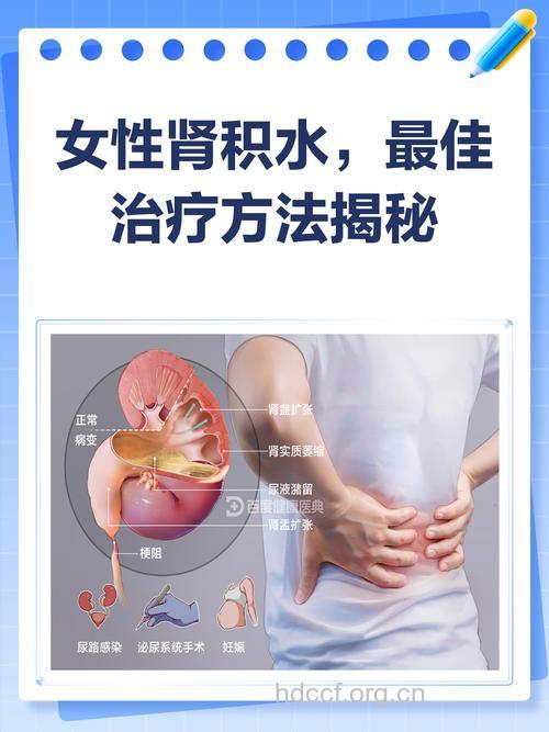 女性肾积水怎么进行调理