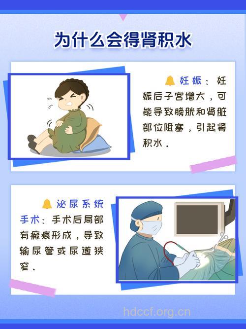 肾积水能根治吗