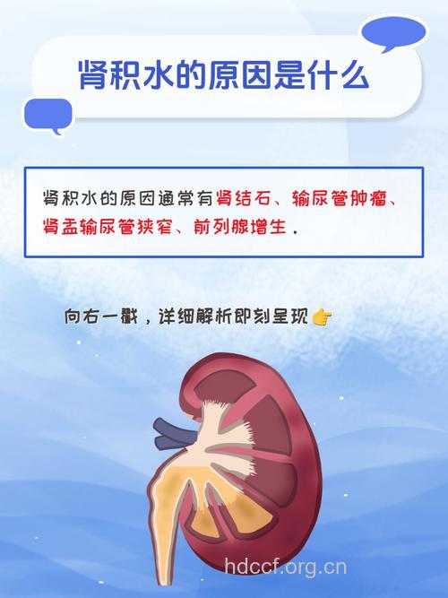 让肾积水高发的三大病因
