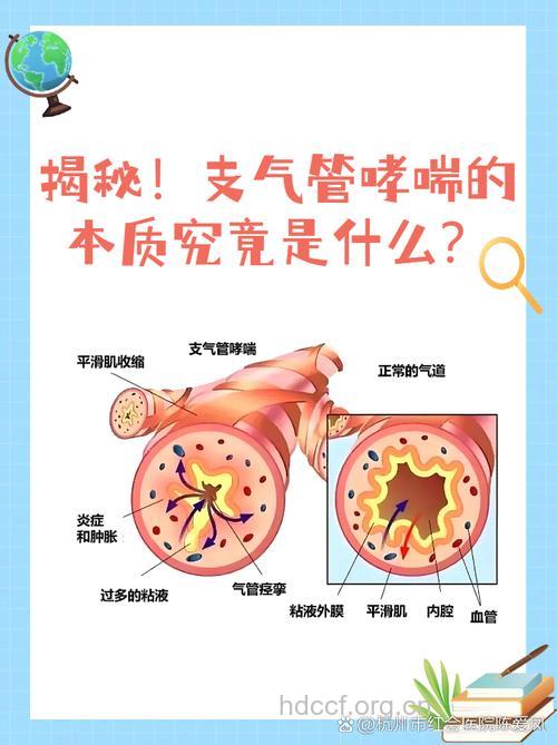 严重支气管哮喘有什么发病特点