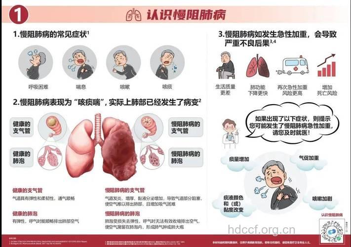 走出对慢阻肺的认识误区