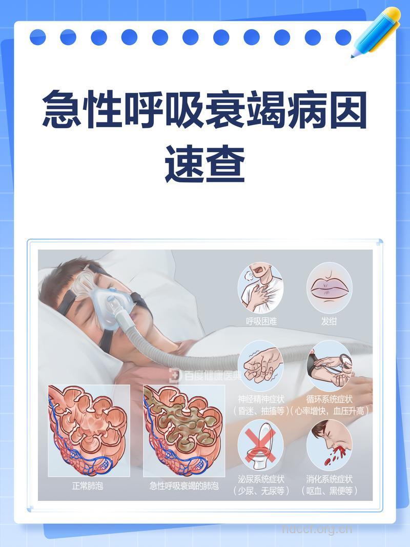 专家解读：呼吸衰竭