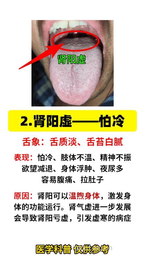 从舌头如何判断是否肾虚