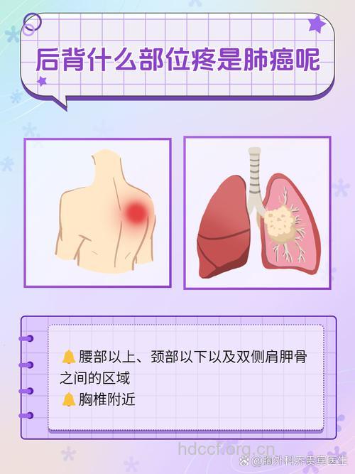 肩背痛可能是肺癌信号