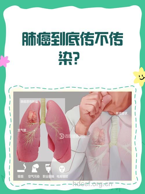 肺癌会不会传染给别人