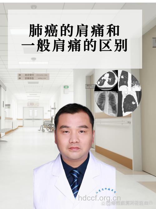 老人肺癌引起的肩臂痛有哪些特点