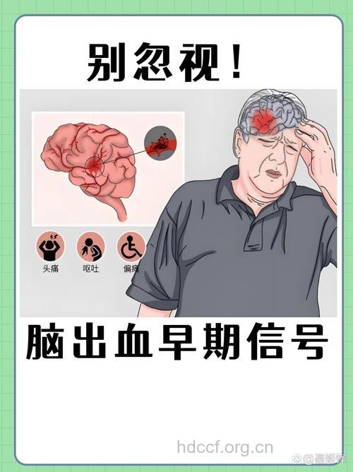 高血压患者警惕脑血管破裂前的10个征兆