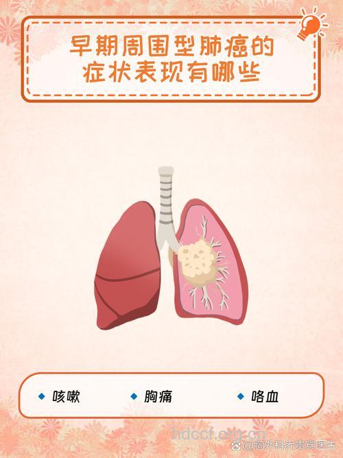 早期周围型肺癌有哪些症状