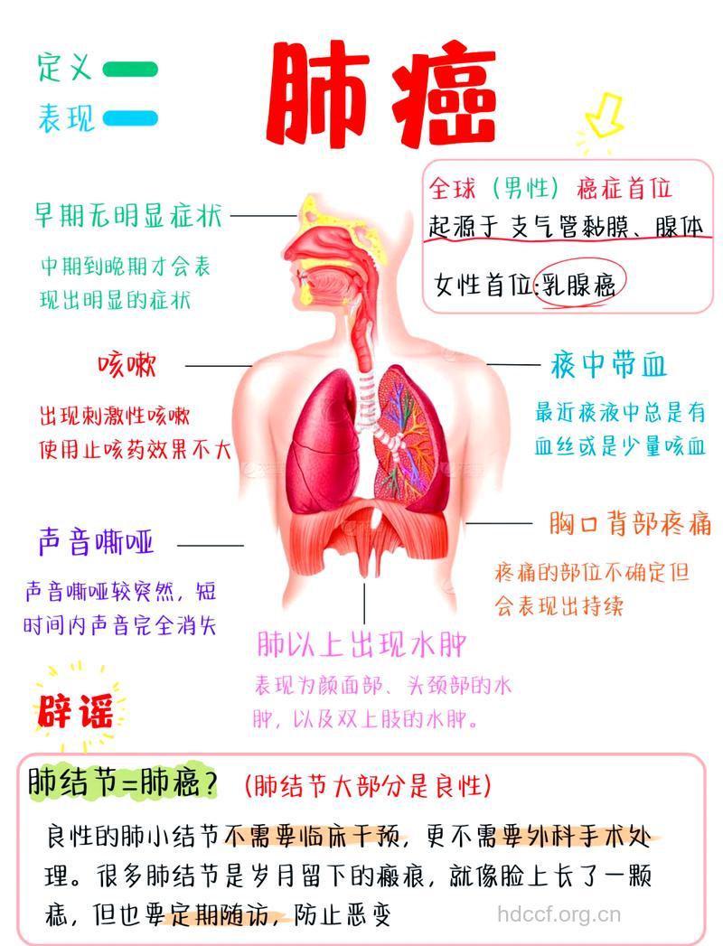 您了解女性肺肿瘤早期症状吗