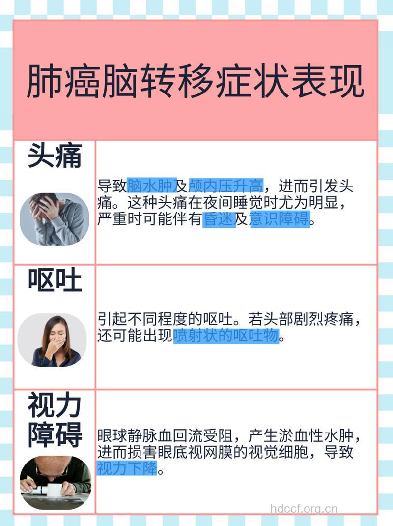 早期肺癌脑转移的几个症状