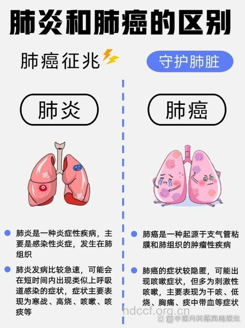 黎汉持因肺炎去世 肺炎与肺癌的关系