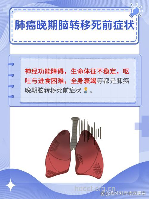 肺癌晚期死前症状