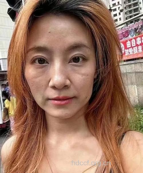 肾虚导致女性容颜老
