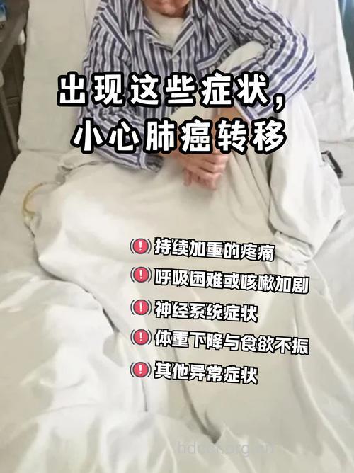肺癌转移时期有什么症状表现呢