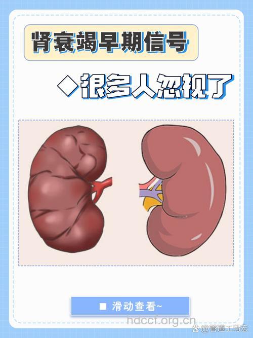 10个信号告诉你肾脏存隐患