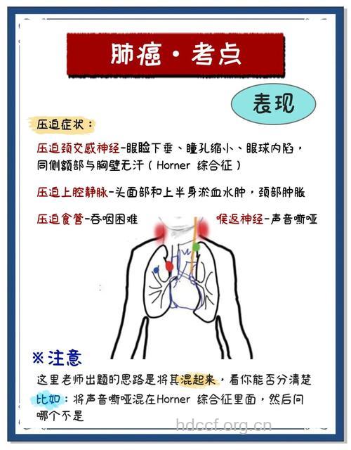 怎么正确认识肺癌方法