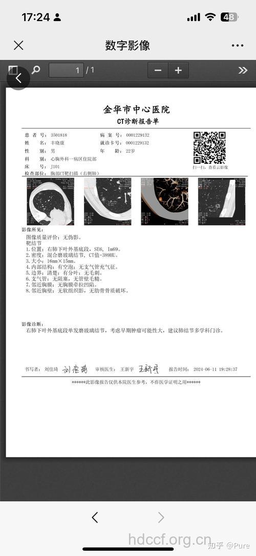 肺癌早期如何诊断