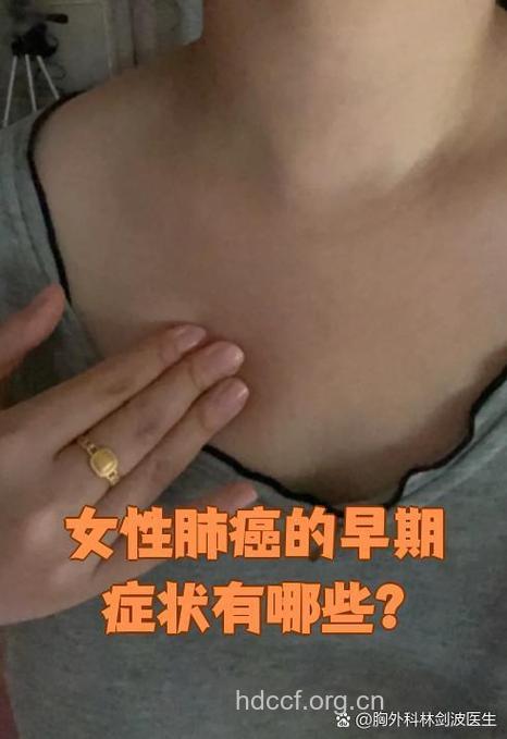 女性肺癌的早期有哪些症状呢