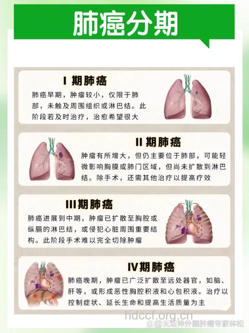 肺癌中晚期的症状有哪些呢