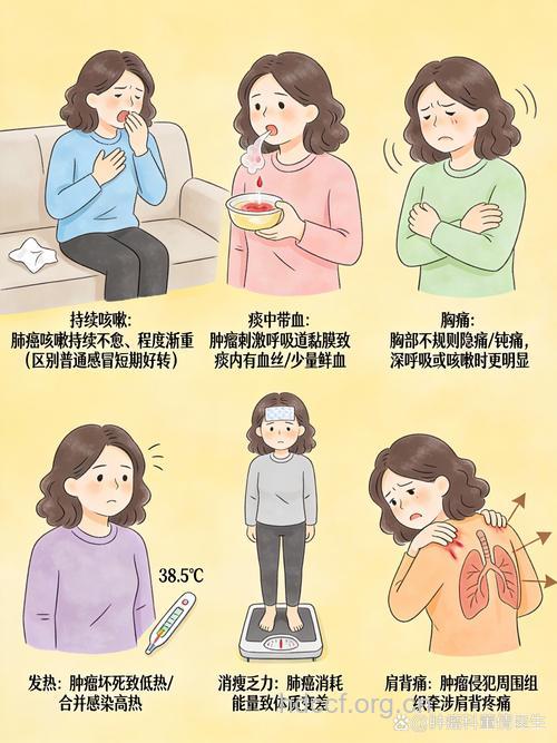 女性早期肺癌的症状有哪些呢