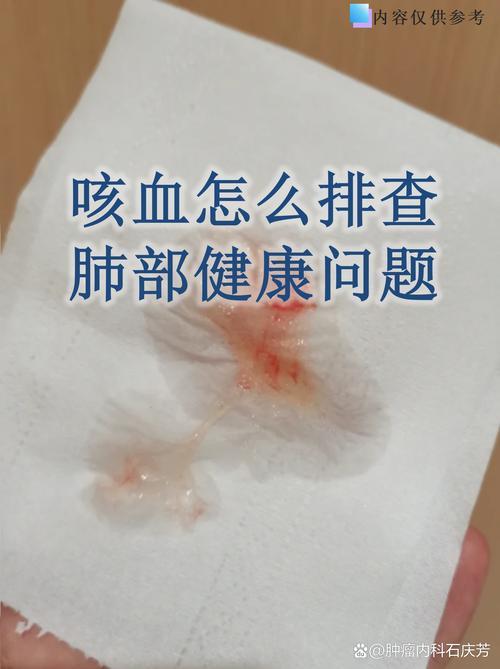 咯血是肺癌的早期症状吗