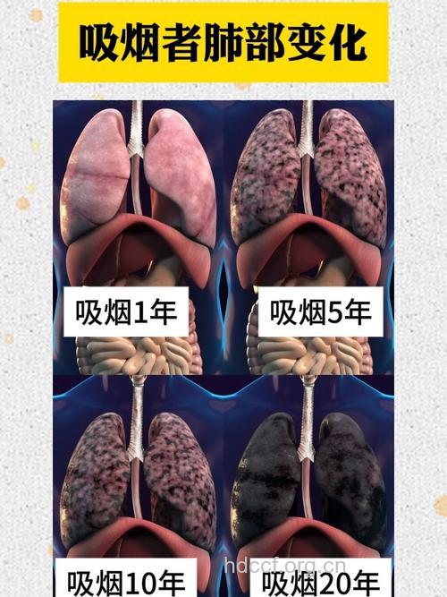 肺癌病人吸烟后的症状