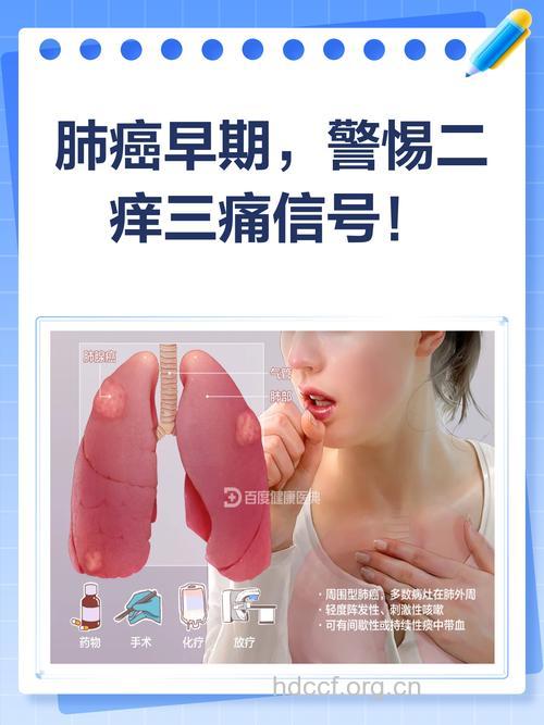 感染了肺癌有哪些早期症状容易发生