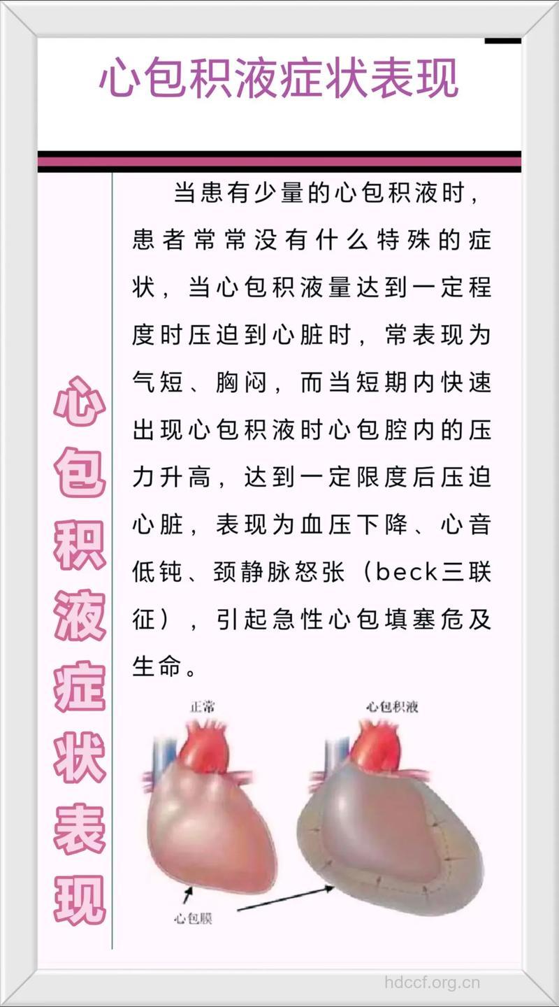 心包积液是肺癌的症状吗