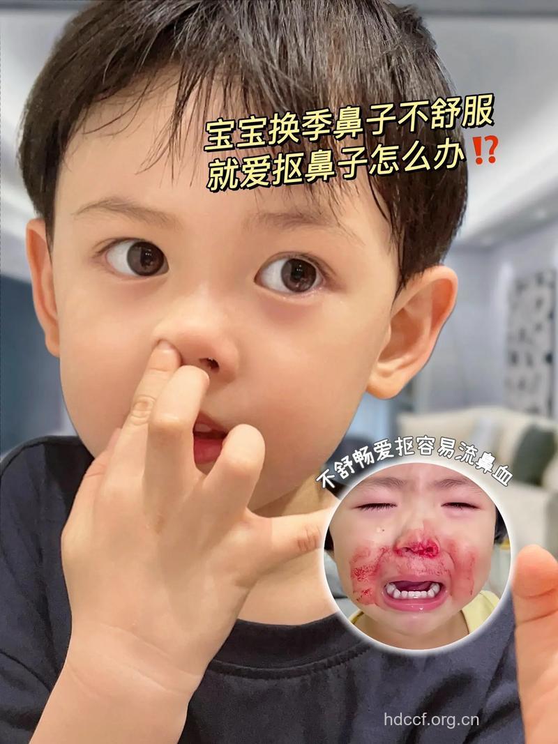 常用手挖鼻孔容易得鼻炎