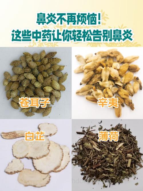 鼻炎的常见症状及治疗偏方