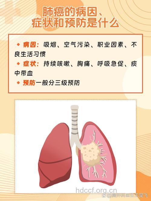 预防肺癌应做好四个环节