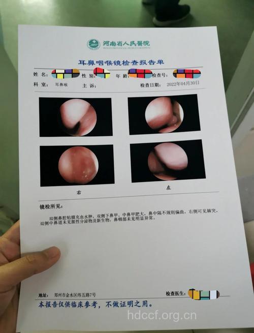 鼻窦炎的检查项目有哪些