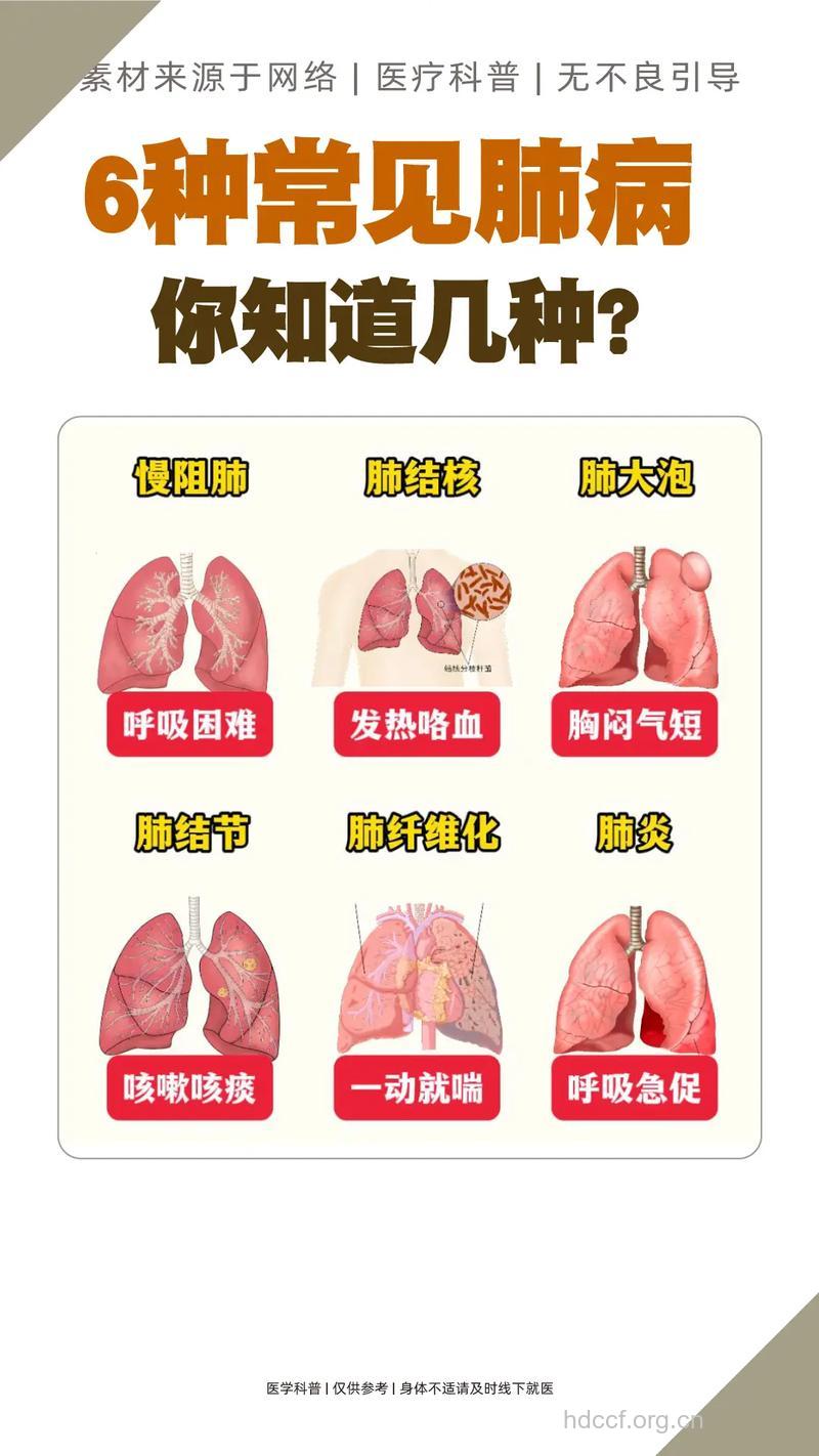 肺癌常见肺内症状有哪些