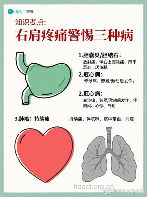 肩痛久治不愈应警惕肺癌