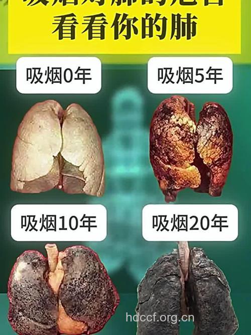 每年吸烟超400支易得肺癌