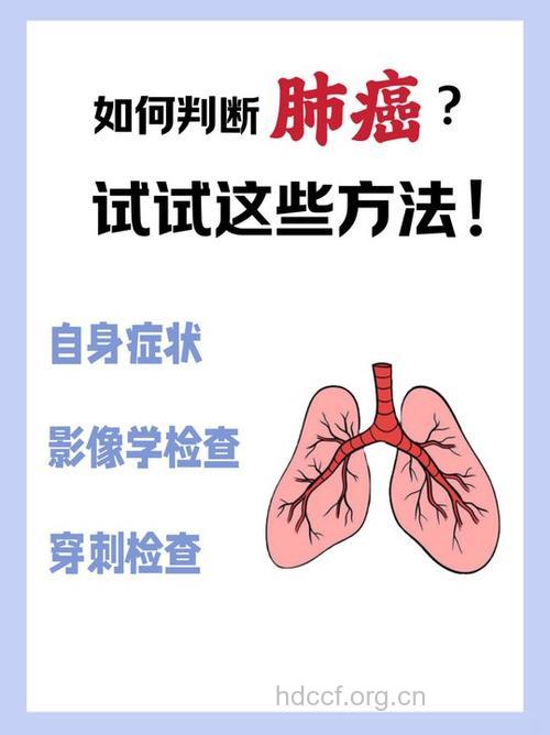 怎样预测肺癌的复发?