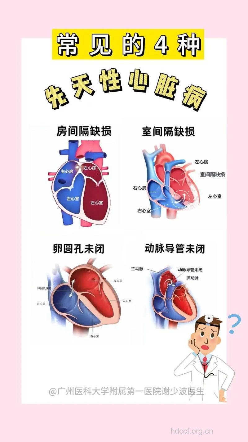 导致先天性心脏病的几个原因