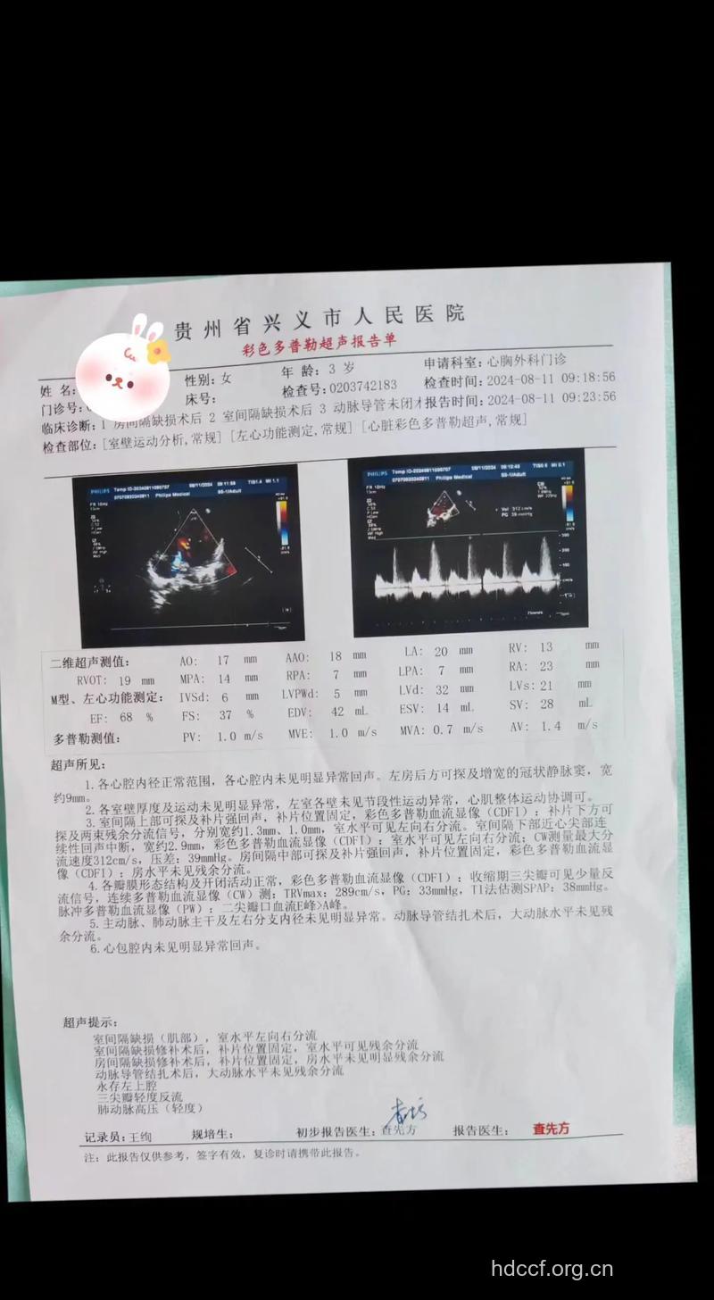 先天性心脏病诊断及症状