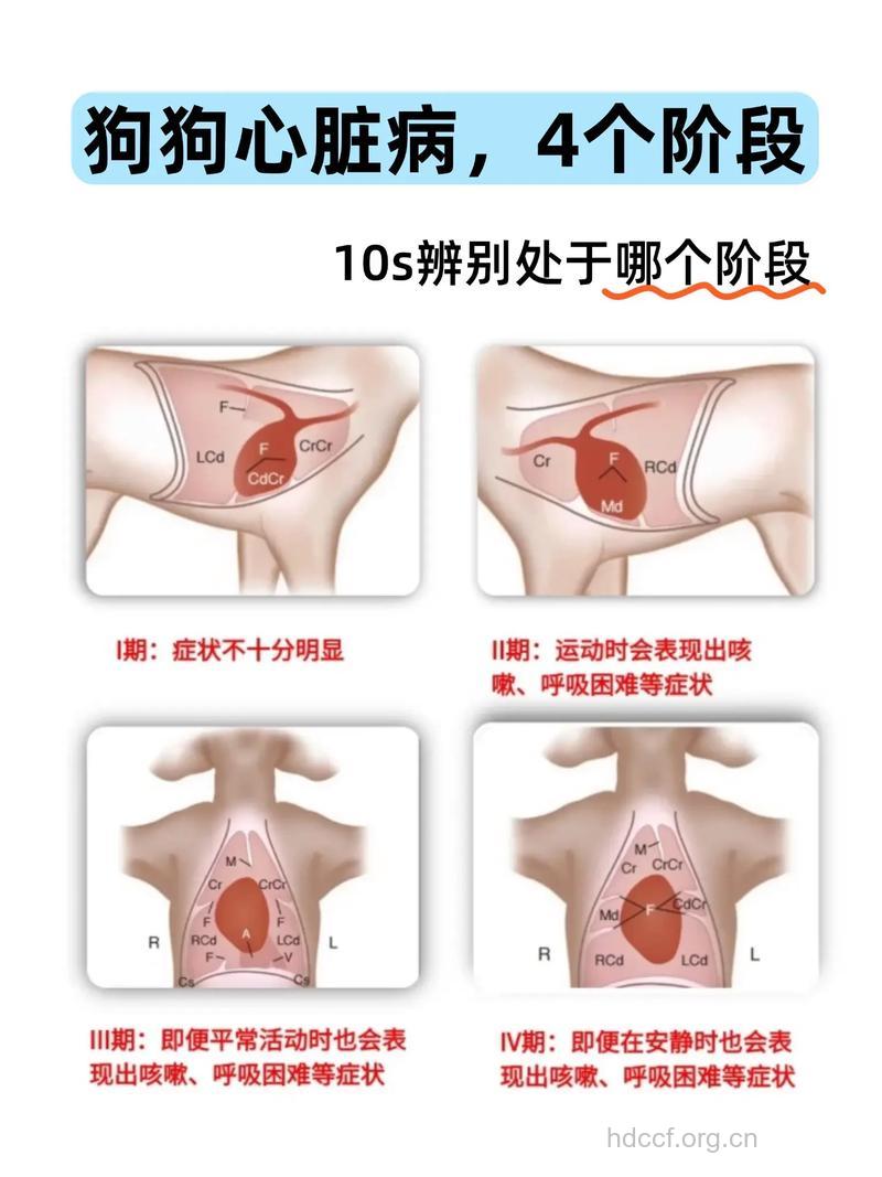 如何判断是否患有心脏病