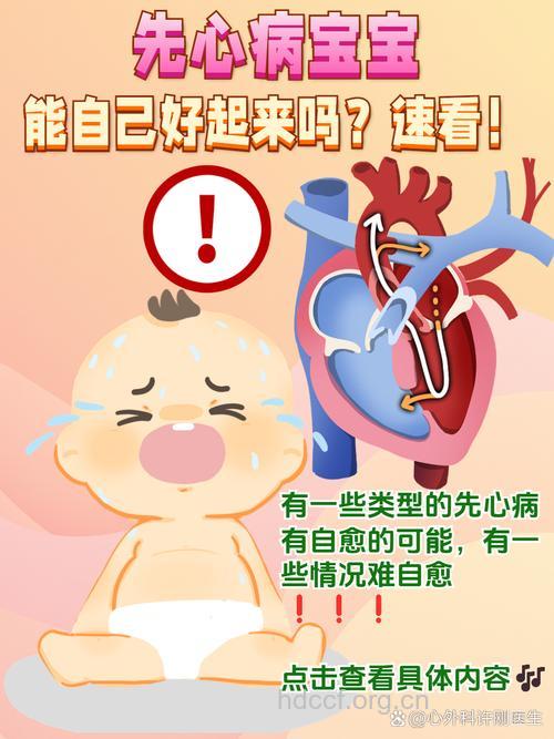 儿童患了先心病 应该尽快治疗