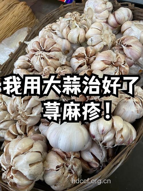 大蒜能治好牙过敏