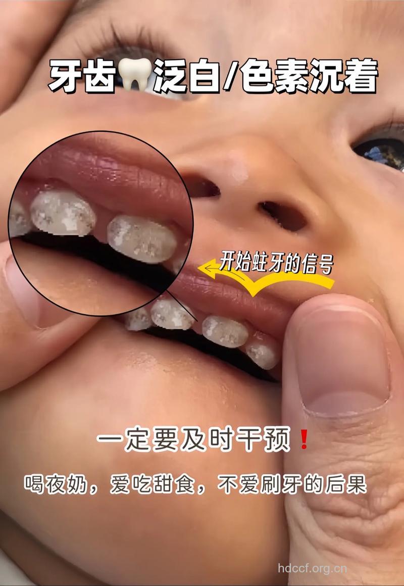 伤害宝宝乳牙的5个坏习惯 宝妈别再犯