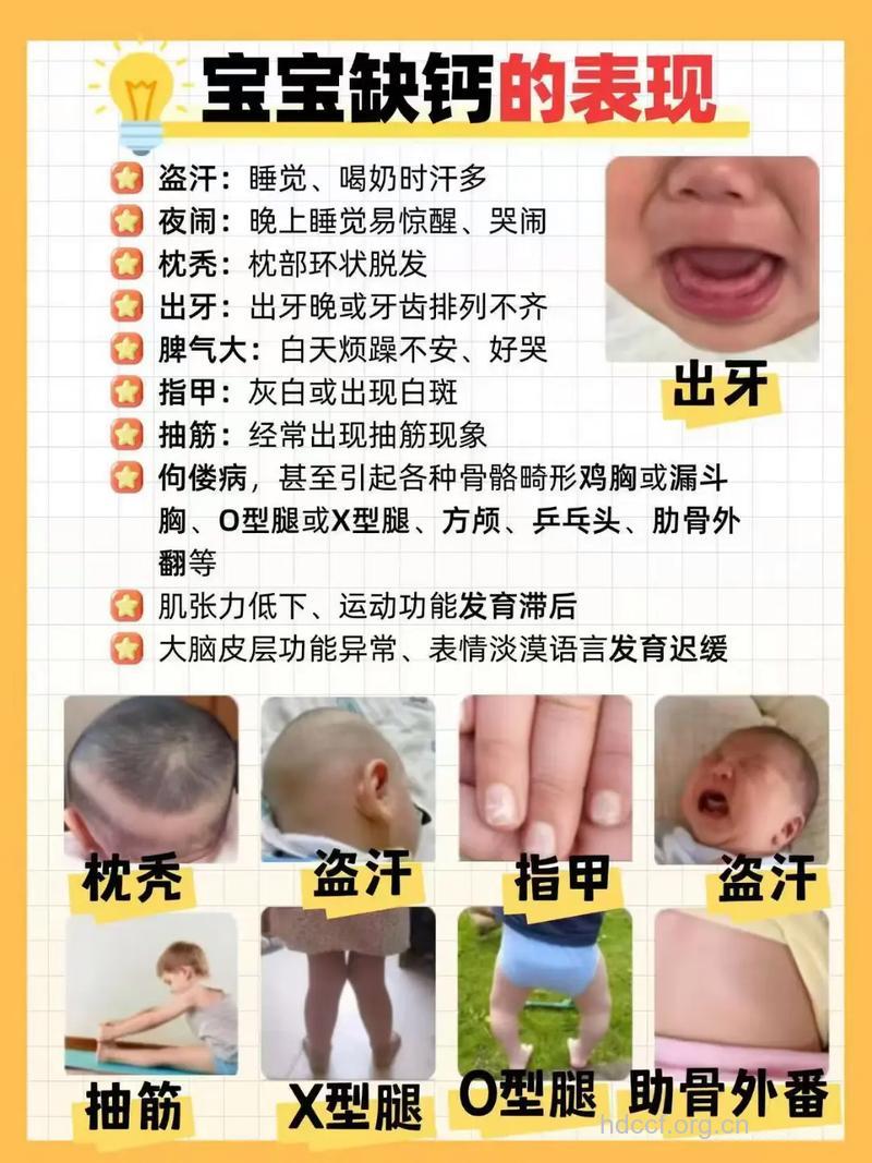 最需要补钙的三类宝宝