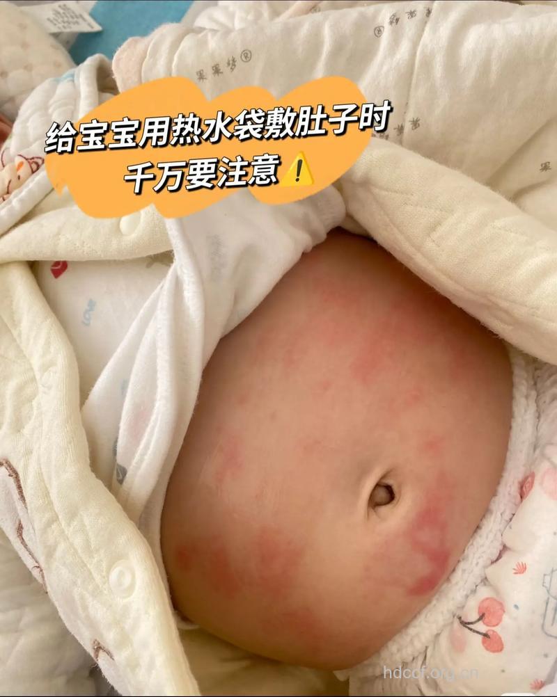 冬季宝宝腹部保暖护理