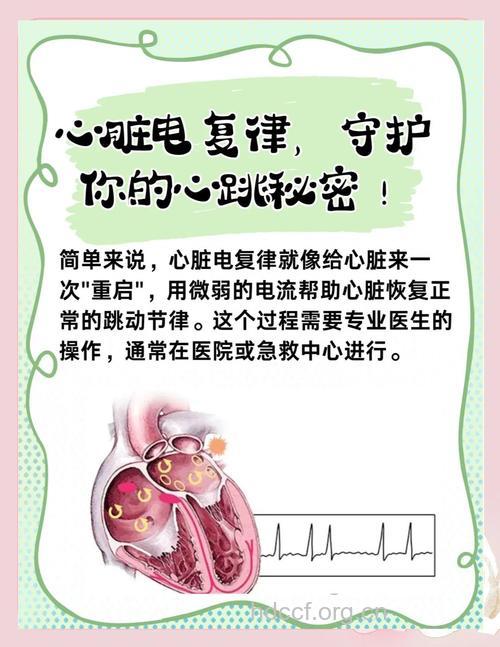 心脏电复律