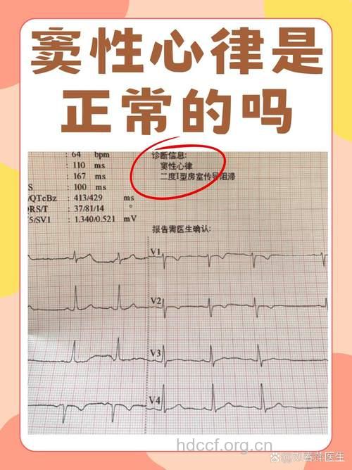 呼吸性窦性心律不齐是病吗