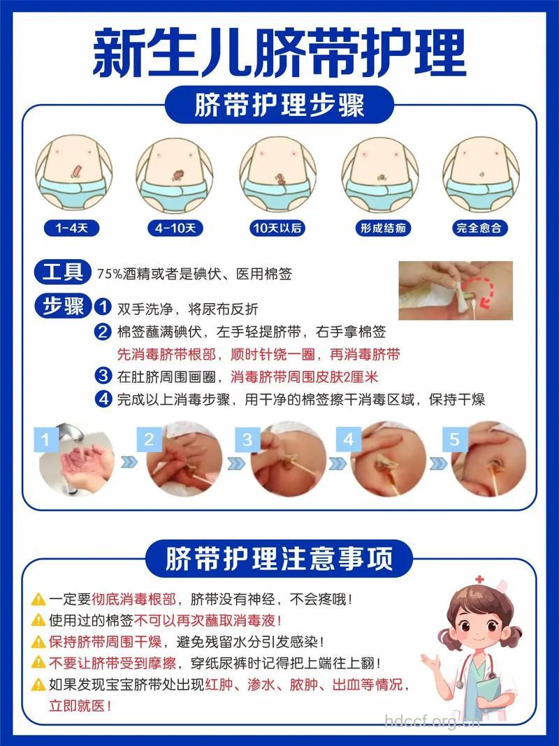 新生儿肚脐有什么护理要点