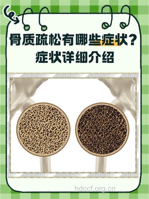 研究称维生素E可导致骨质疏松