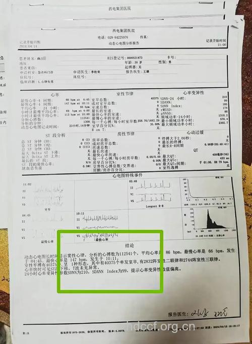 西医对心律失常治疗