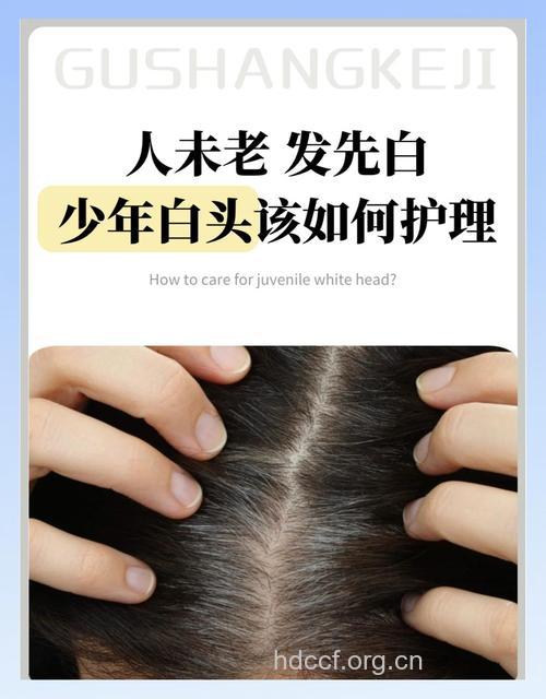 怎样预防少年白头